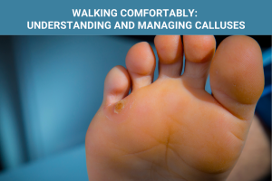 Walking Comfortably Understanding and Managing Calluses